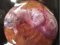 Egg candling view on day 16