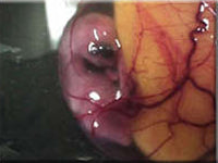 Egg candling view on day 14