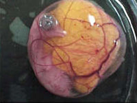 Egg candling view on day 15