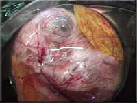 Egg candling view on day 17