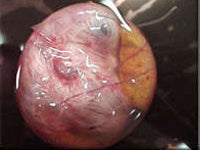 Egg candling view on day 18